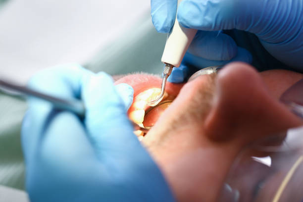 Best Emergency Denture Repair in Harrisville, PA